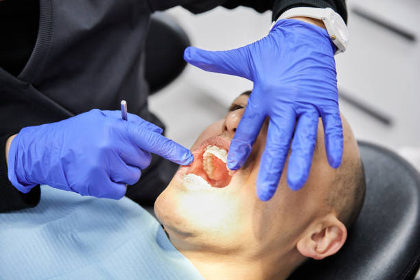 Best Emergency Treatment for Oral Infections in Fairmead, CA